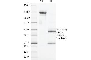 SDS-PAGE Analysis Purified CD32 Mouse Monoclonal Antibody (7. (FCGR2A Antikörper)