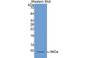 Western blot analysis of the recombinant protein. (CCL5 Antikörper  (AA 24-91))