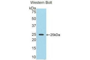 Western Blotting (WB) image for anti-Nexilin (NEXN) (AA 409-605) antibody (ABIN1859994)