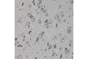 Immunohistochemistry of paraffin-embedded rat brain using UQCRC1 antibody (ABIN1875287) at dilution of 1:100 (40x lens).