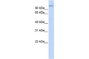 WB Suggested Anti-TXNDC16 Antibody Titration:  0. (TXNDC16 Antikörper  (N-Term))
