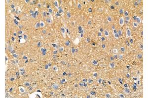 ABIN6257800 and ABIN6273894 at 1/100 staining Rat brain tissue by IHC-P. (NPBWR2 Antikörper  (C-Term))