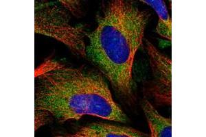 Immunofluorescent staining of human cell line U-2 OS with KARS polyclonal antibody  at 1-4 ug/mL dilution shows positivity in cytoplasm. (KARS Antikörper)