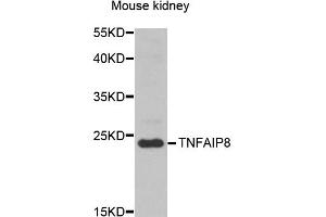 Western blot analysis of extracts of mouse kidney, using TNFAIP8 antibody (ABIN5974482) at 1/1000 dilution. (TNFAIP8 Antikörper)
