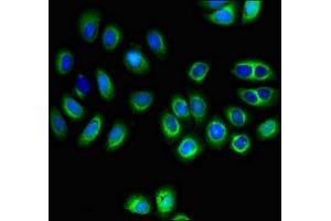 Immunofluorescent analysis of A549 cells using ABIN7160169 at dilution of 1:100 and Alexa Fluor 488-congugated AffiniPure Goat Anti-Rabbit IgG(H+L) (MCT3 Antikörper  (AA 432-504))