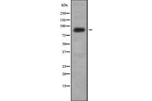 Western blot analysis IL-4R alpha using K562 whole cell lysates (IL4 Receptor Antikörper  (N-Term))
