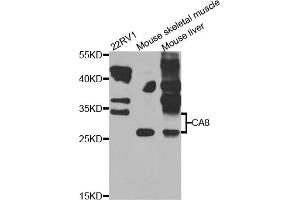 Western blot analysis of extracts of various cell lines, using CA8 antibody (ABIN5975602) at 1/1000 dilution. (CA8 Antikörper)