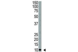 Western Blotting (WB) image for anti-Ubiquitin (Ub) (AA 1-32) antibody (ABIN3029419)