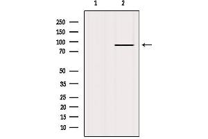 Western blot analysis of extracts from HepG2, using FGFR2 Antibody. (FGFR2 Antikörper  (C-Term))