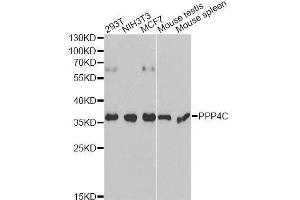 Western blot analysis of extracts of various cell lines, using PPP4C antibody. (PPP4C Antikörper  (AA 1-307))