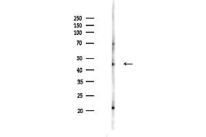 anti-Dihydrolipoamide Branched Chain Transacylase E2 (DBT) (C-Term) antibody