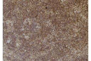 ABIN6257013 and ABIN6274965 at 1/100 staining Mouse spleen tissue by IHC-P. (CBR3 Antikörper  (C-Term))