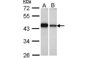 WB Image Sample (30 ug of whole cell lysate) A: A431 , B: Hela 10% SDS PAGE antibody diluted at 1:1000