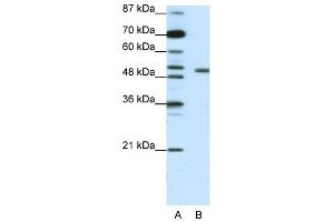 KCNAB2 antibody used at 1. (KCNAB2 Antikörper  (Middle Region))