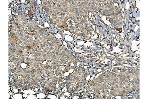 IHC analysis of PDIA6 using anti-PDIA6 antibody (ABIN7600553). (PDIA6 Antikörper  (AA 20-440))