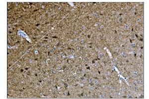 IHC analysis of CAMKIV/Camk4 using anti-CAMKIV/Camk4 antibody (ABIN7600419). (CAMK4 Antikörper  (AA 19-469))