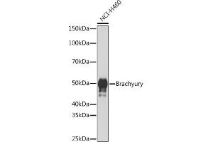 Western blot analysis of extracts of NCI-H460 cells, using Brachyury Rabbit mAb (ABIN1682626, ABIN3019362, ABIN3019363 and ABIN7101757) at 1:1000 dilution. (Scinderin Antikörper)