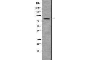 Western blot analysis of CTNNAL1 using HuvEc whole cell lysates