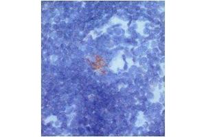 Immunohistochemistry (IHC) image for anti-C-Type Lectin Domain Family 6, Member A (CLEC6A) (full length) antibody (ABIN2443870)