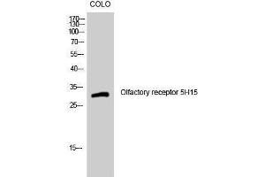 Western Blotting (WB) image for anti-Olfactory Receptor, Family 5, Subfamily H, Member 15 (OR5H15) (C-Term) antibody (ABIN3186156) (OR5H15 Antikörper  (C-Term))