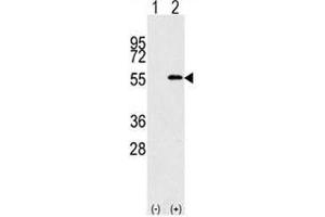 Western blot analysis of NUP50 antibody and 293 cell lysate (2 ug/lane) either nontransfected (Lane 1) or transiently transfected with the NUP50 gene (2).