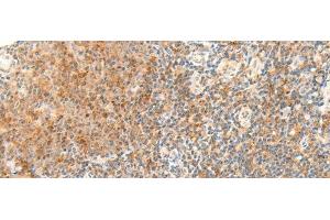 Immunohistochemistry of paraffin-embedded Human tonsil tissue using RAPGEF1 Polyclonal Antibody at dilution of 1:45(x200) (GRF2 Antikörper)