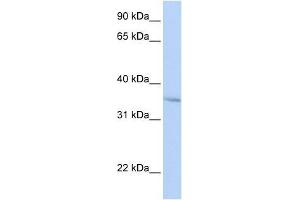 FHL3 antibody used at 0. (FHL3 Antikörper  (Middle Region))