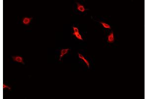 ABIN6269031 staining CACO-2 cells by IF/ICC. (PDGFRA Antikörper  (C-Term))