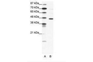 Image no. 1 for anti-gamma-aminobutyric Acid (GABA) A Receptor, pi (GABRP) (AA 28-77) antibody (ABIN202529) (GABRP Antikörper  (AA 28-77))
