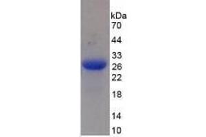 Image no. 1 for Mannan-Binding Lectin serine Peptidase 2 (MASP2) (AA 445-683) (Active) protein (His tag) (ABIN6239794) (MASP2 Protein (AA 445-683) (His tag))