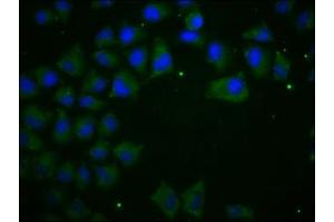 Immunofluorescence (IF) image for anti-Cadherin 1, Type 1, E-Cadherin (Epithelial) (CDH1) (AA 155-707) antibody (ABIN7146194)