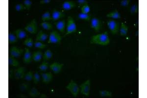 Immunofluorescence staining of Hela cells with ABIN7146194 at 1:100, counter-stained with DAPI. (E-cadherin Antikörper  (AA 155-707))