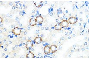 Immunohistochemistry of paraffin-embedded Mouse kidney using NOD1 Polyclonal Antibody at dilution of 1:100 (40x lens). (NOD1 Antikörper)