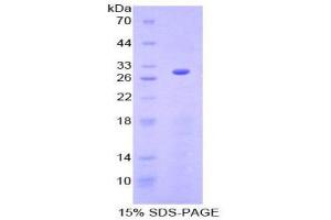 SDS-PAGE (SDS) image for Granulin (GRN) (AA 361-585) protein (His tag) (ABIN2123832)