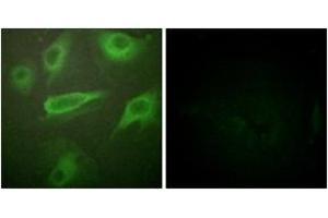 Immunofluorescence analysis of HeLa cells, using IL-4R/CD124 (Phospho-Tyr497) Antibody. (IL4 Receptor Antikörper  (pTyr497))