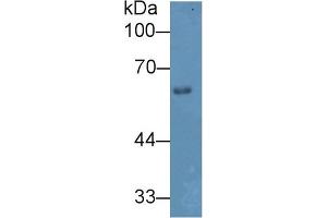 Detection of HPSE in Mouse Skin lysate using Polyclonal Antibody to Heparanase (HPSE) (HPSE Antikörper  (AA 353-464))