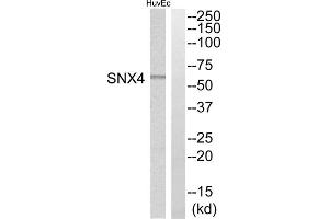 Western blot analysis of extracts from HuvEc cells, using SNX4 antibody. (Sorting Nexin 4 Antikörper  (Internal Region))