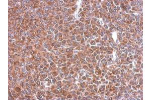 IHC-P Image Immunohistochemical analysis of paraffin-embedded BT483 xenograft, using STIP1, antibody at 1:500 dilution. (STIP1 Antikörper)