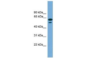 WB Suggested Anti-C19orf45 Antibody Titration: 0. (C19ORF45 Antikörper  (Middle Region))