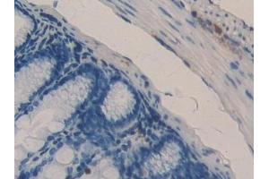 Immunohistochemistry (IHC) image for anti-Dihydrolipoamide Dehydrogenase (DLD) (AA 45-271) antibody (ABIN7432892)