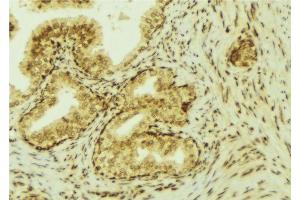 ABIN6277270 at 1/100 staining Mouse colon tissue by IHC-P. (VEGFC Antikörper  (Internal Region))