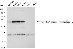 Western blotting analysis using Interleukin 1 receptor associated kinase 2 antibody (ABIN7799113).