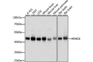 Western blot analysis of extracts of various cell lines, using  antibody (ABIN7265674) at 1000 dilution. (ARMC6 Antikörper  (AA 1-220))