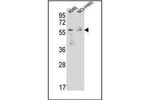 Western blot analysis of FOXN1 Antibody (Center) in A549,NCI-H460 cell line lysates (35ug/lane). (FOXN1 Antikörper  (Middle Region))
