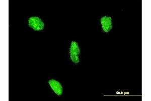 Immunofluorescence of monoclonal antibody to LHX3 on HeLa cell. (LHX3 Antikörper  (AA 228-316))