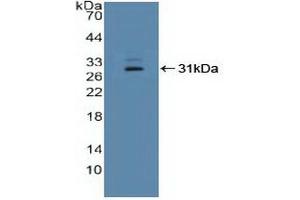 Western blot analysis of recombinant Human IFI16. (IFI16 Antikörper  (AA 465-671))