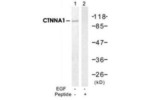 Western blot analysis of extract from A-431 cells, untreated or treated with EGF (200ng/ml, 30min), using CTNNA1 polyclonal antibody (Cat # PAB12225, Lane 1 and 2).