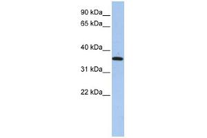 WB Suggested Anti-FAM84A Antibody Titration: 0. (FAM84A Antikörper  (N-Term))