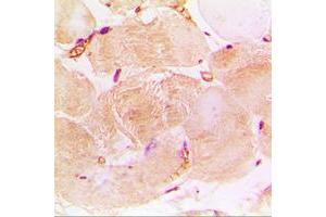 Immunohistochemistry (IHC) image for anti-Cardiac Troponin I (TNNI3) (Center) antibody (ABIN7297174)
