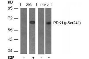 Image no. 2 for anti-3-phosphoinositide Dependent Protein Kinase-1 (PDPK1) (pSer241) antibody (ABIN196616) (PDPK1 Antikörper  (pSer241))